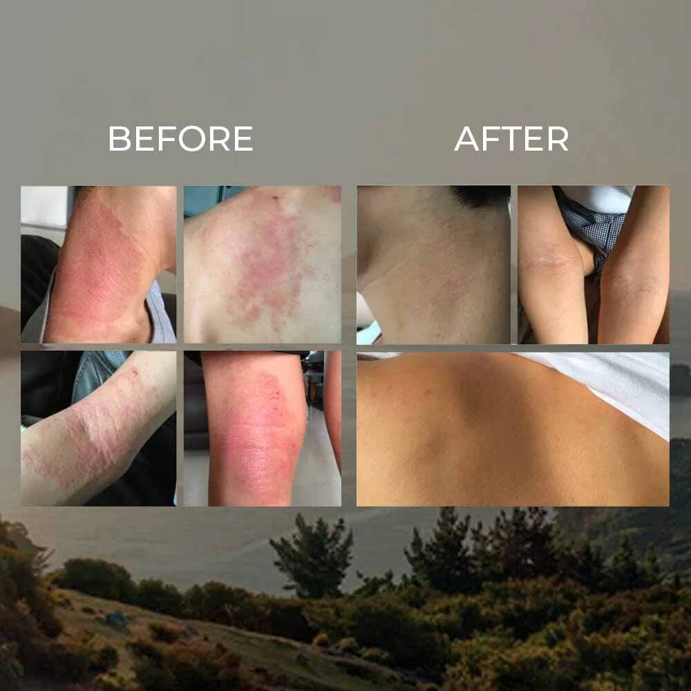 Sven's Island Miracle Manuka Skin Repair Ointment - 100g