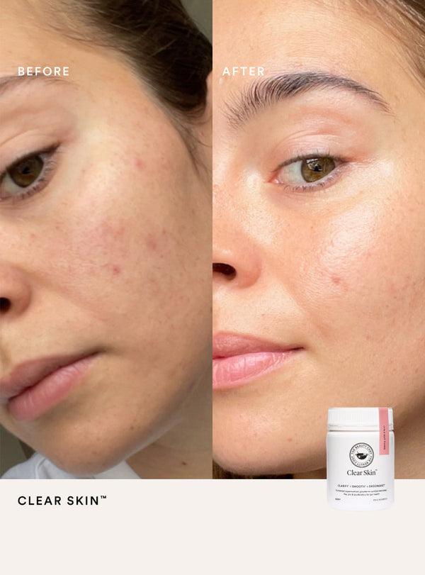 The Beauty Chef Clear Skin Berry Inner Beauty Powder - 150g