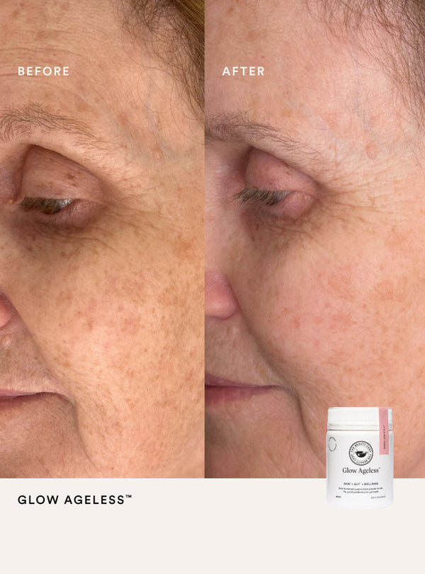Before and after comparison of a person's eye area with a bottle labeled 'Glow Ageless' on a white background.
