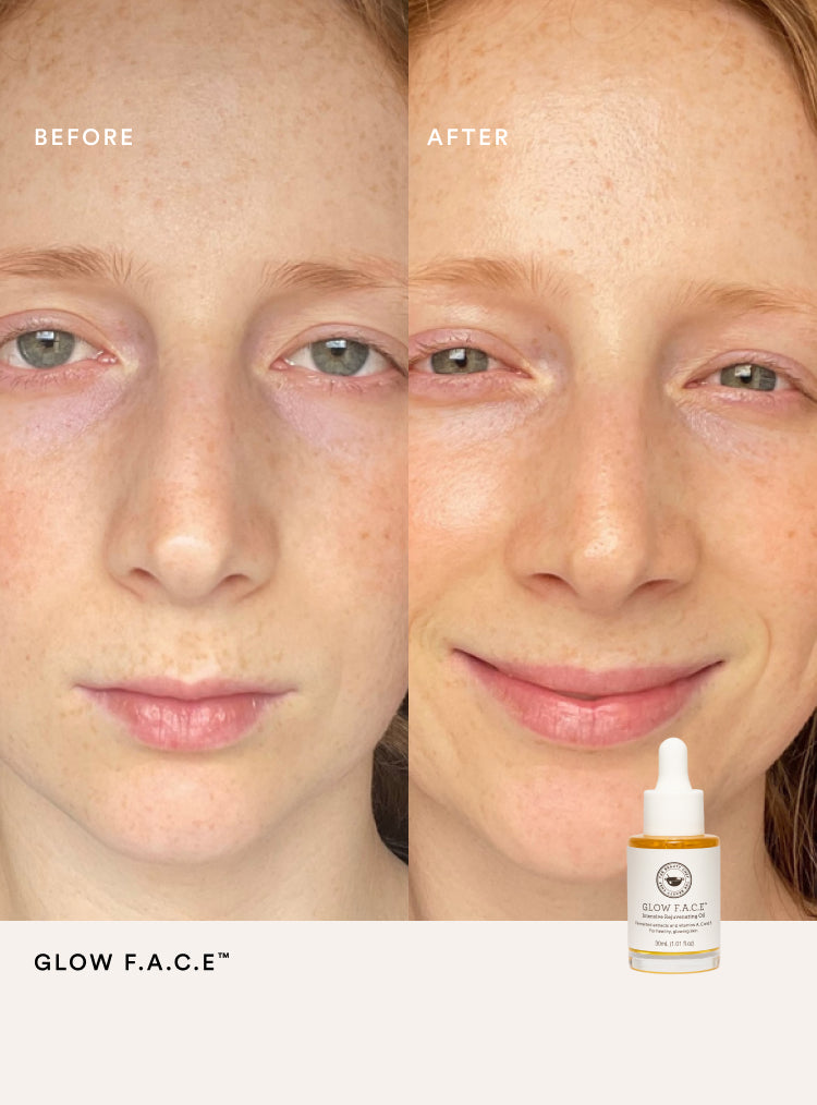 Before and after comparison of a person's face with a bottle of Glow F.A.C.E. product.
