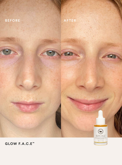 Before and after comparison of a person's face with a bottle of Glow F.A.C.E. product.