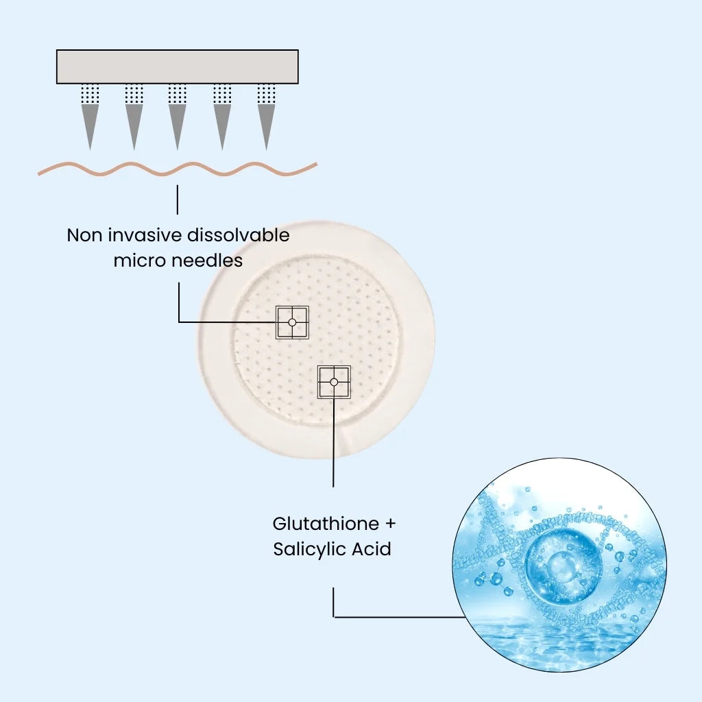 The Patch Remedy Microneedle Patches - The Blemish Remedy - 24 Patches